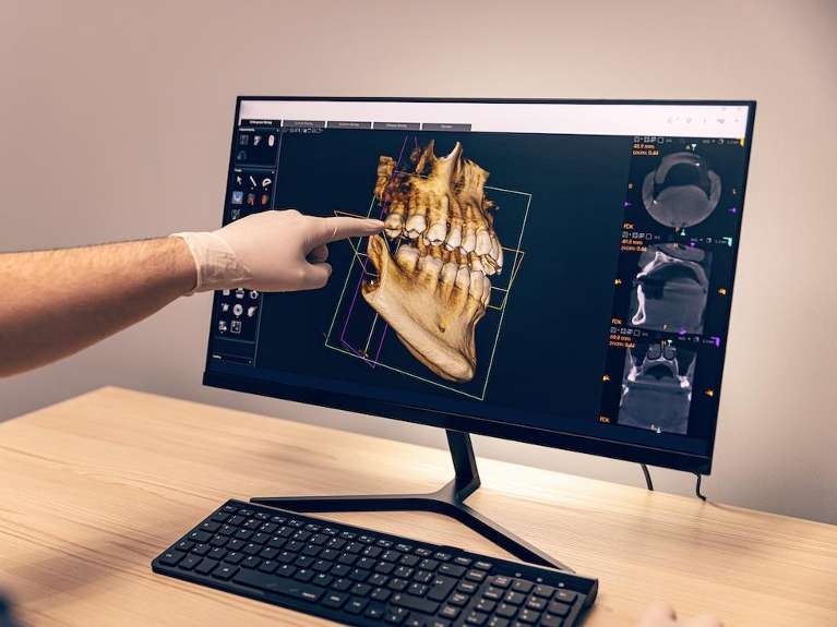 CBCT Cone Beam Technology