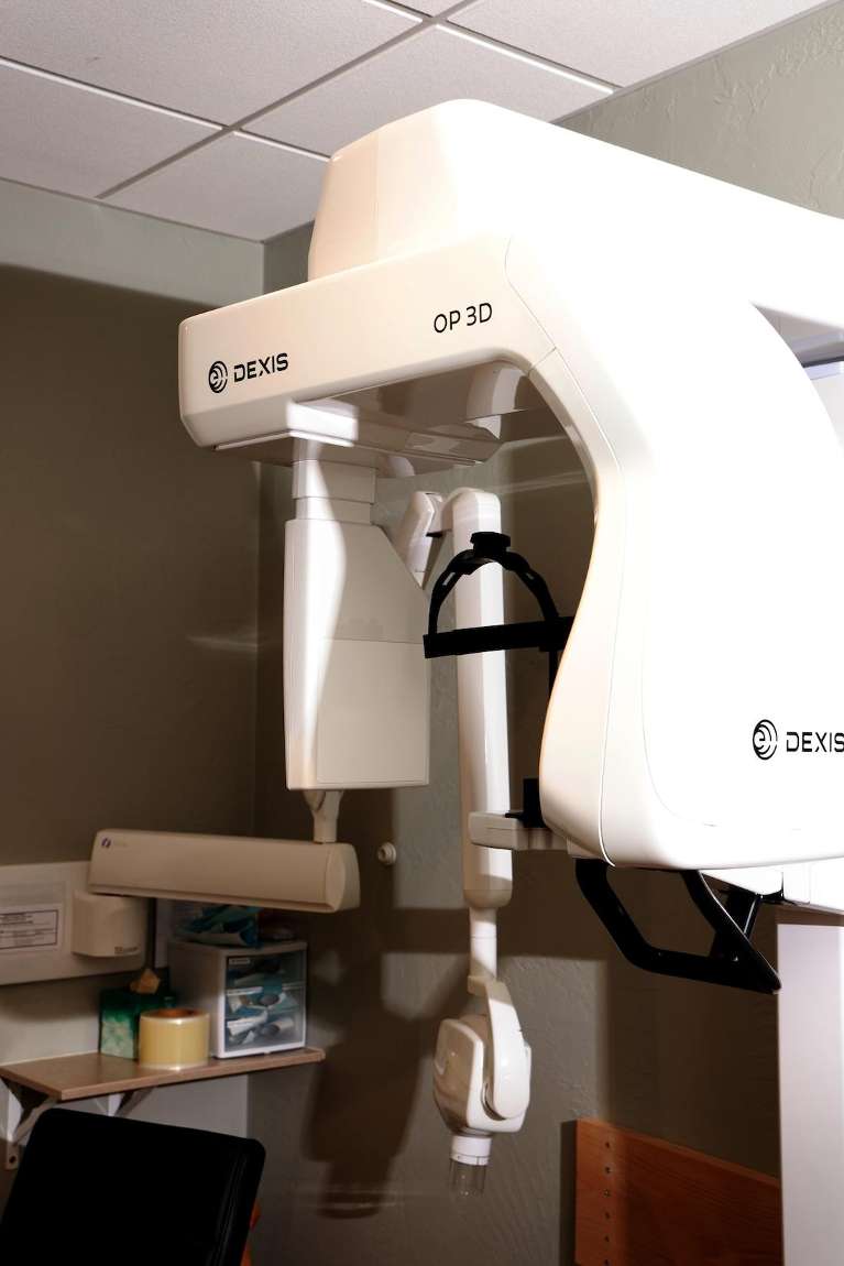 Digital X-Rays at appleton dental office